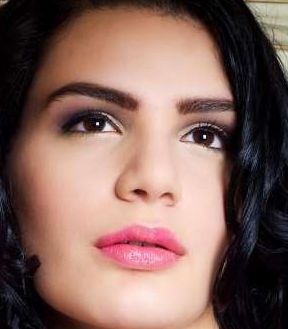 王太玲雙眼皮修復(fù)前后效果展示，讓您信心重拾！