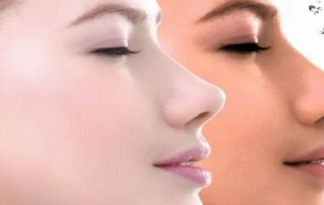 國(guó)內(nèi)十大隆鼻醫(yī)院官方認(rèn)證！精選口碑醫(yī)院，曙光、美萊等實(shí)力推薦！