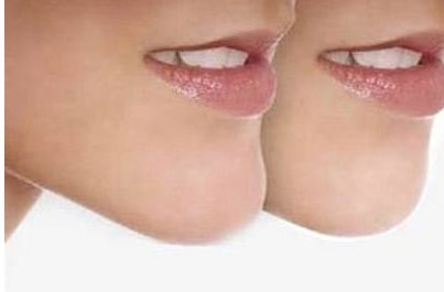 成都頂尖的玻尿酸注射醫(yī)生排行榜，六位信譽好的醫(yī)生介紹