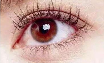 新疆有哪家整形醫(yī)院舉辦眼鼻優(yōu)惠專場活動？預交300能抵600嗎？