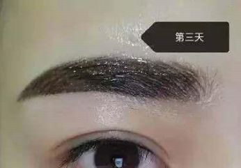 長沙美萊隆胸醫(yī)生的評(píng)價(jià)如何？醫(yī)療背景與口碑信息一一梳理