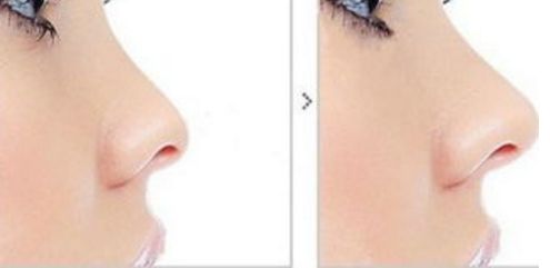 醫(yī)術(shù)精湛！感受武漢整形醫(yī)院魅力，解鎖變美新境界！