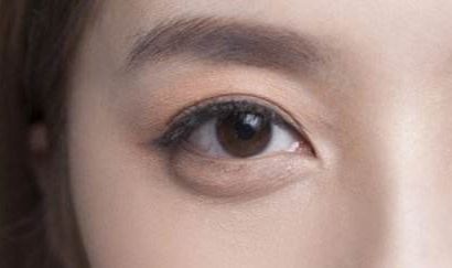 2023最新！精彩譚謙雙眼皮案例大揭秘，實景術后反饋引爆網(wǎng)絡