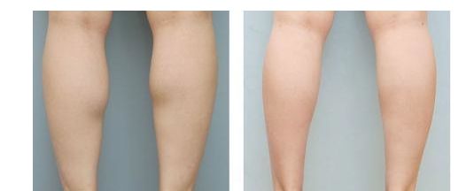 尋找蘇州市最佳雙眼皮整形醫(yī)生，專家排行榜最新發(fā)布