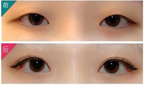 深圳美萊郭杰整形技術(shù)分析及專家背景揭秘