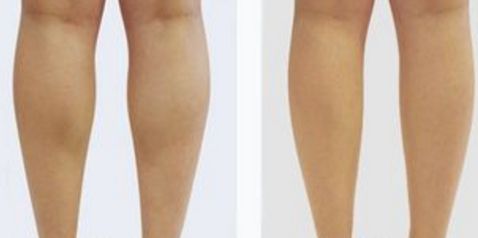 北京八大處楊欣好評傳遍朋友圈！揭秘90天顛覆性隆鼻之旅