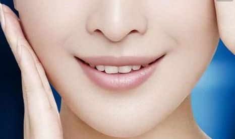 上海張宇醫(yī)生的雙眼皮修復(fù)經(jīng)驗(yàn)與案例分享