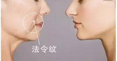 韋元強(qiáng)swan吸脂修復(fù)方法介紹，相關(guān)醫(yī)院推薦