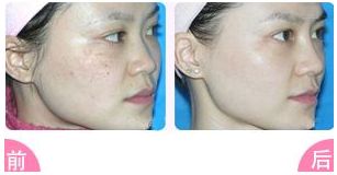 榆林二院整形科值得信賴嗎？醫(yī)生專業(yè)，雙眼皮案例豐富，收費(fèi)明明白白，專家指南！