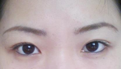 北京明會紅醫(yī)療美容診所價格表真實嗎？你會不會覺得有點匪夷所思？