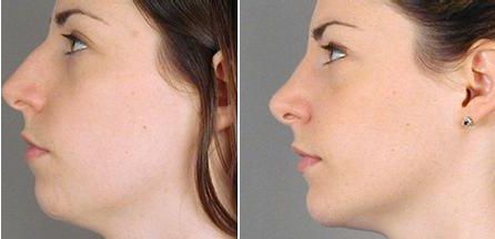 山東頂級(jí)整容醫(yī)院推薦！專業(yè)醫(yī)療機(jī)構(gòu)盤點(diǎn)，你值得擁有