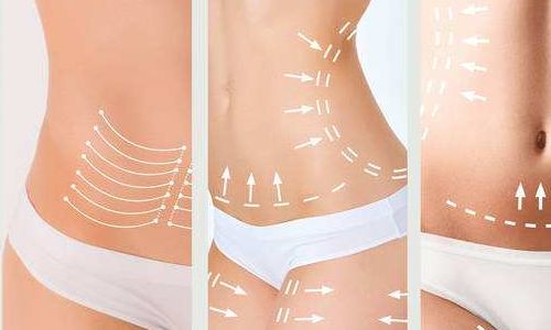 2023年武漢吸脂抽脂醫(yī)生（專(zhuān)家）技術(shù)分享：張軍、張繼強(qiáng)、劉洋等探討