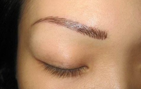 上海伯思立王艷隆鼻效果怎么樣？肋軟骨隆鼻真實案例及收費一覽