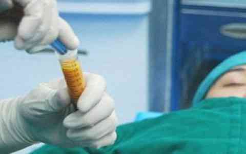 北京雙眼皮整形機構(gòu)強院到底有幾家？眼王坐診屬于哪些級別？