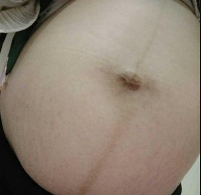 揭示濰坊市熱門(mén)隆鼻醫(yī)院排行榜！尋找濰坊隆鼻首選醫(yī)療機(jī)構(gòu)TOP10！