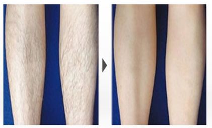 2023年醫(yī)療美容門戶,了解成都整形醫(yī)院實(shí)力，權(quán)威機(jī)構(gòu)匯總