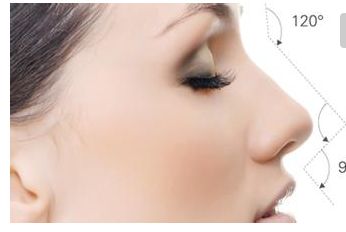 無(wú)錫二院隆鼻效果及費(fèi)用情況詳解，醫(yī)生分享成功案例