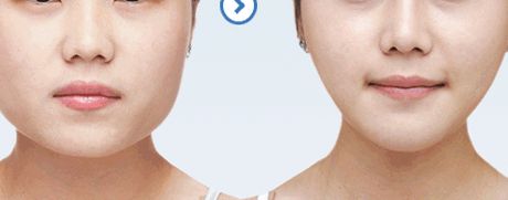 461醫(yī)院植牙科綜合評測：醫(yī)生隊(duì)伍強(qiáng)大，成功案例豐富，價(jià)格表詳解