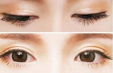 青島壹美天成整形醫(yī)院的隆鼻技術(shù)如何？看看這些真實(shí)案例！