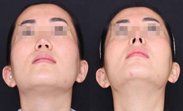 樂山整形美容醫(yī)院綜合排行榜