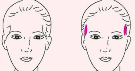 成都軍大醫(yī)院外切眼袋手術(shù)效果及評價分析