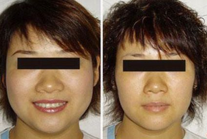 南京診療權(quán)威發(fā)布南京整形醫(yī)院綜合品質(zhì)推薦