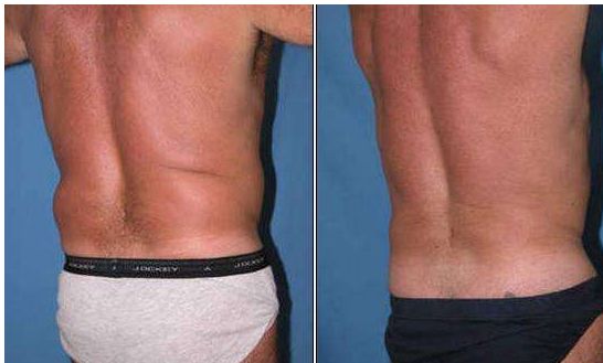 成都隆鼻專家推薦的技術(shù)排名前十，絕對讓你滿意