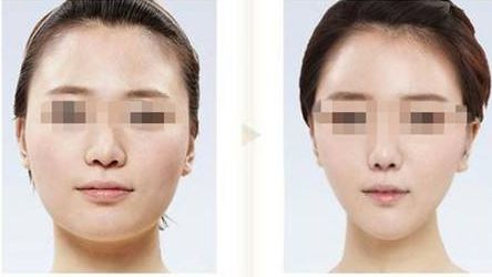 江蘇哪家整形醫(yī)院口碑好