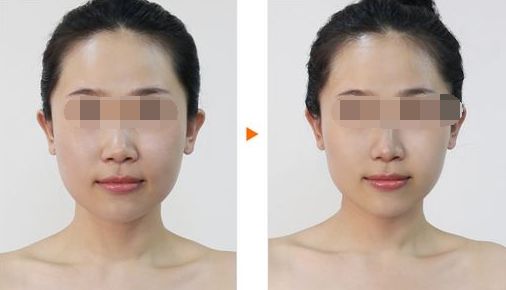 廣州哪家整形醫(yī)院好？排名前十值得推薦