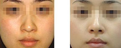 2024年武漢痘痘治療中心綜合排行