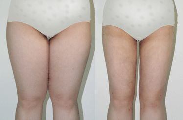 成都抗衰無年齡界限：亨特整形助您青春煥發(fā)！