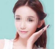 首屈一指的北京瘦身?？漆t(yī)院排行榜