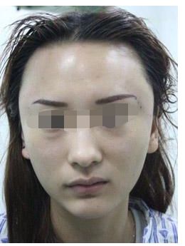 浙江地區(qū)有哪些知名鼻部整形私立醫(yī)院？