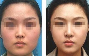 南通瘦身整形醫(yī)院哪家專業(yè)？