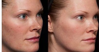 臺州市哪家做除皺瘦臉整形好的美容醫(yī)院推薦