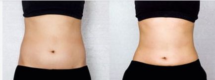 北京大學(xué)醫(yī)院眼部整形怎么樣？真實案例分享+醫(yī)生介紹