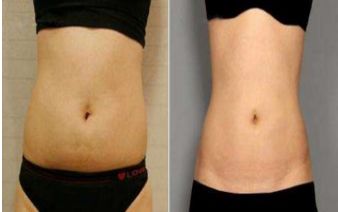 成都哪家醫(yī)院適合做光子嫩膚？排名前五的醫(yī)美機構(gòu)推薦！