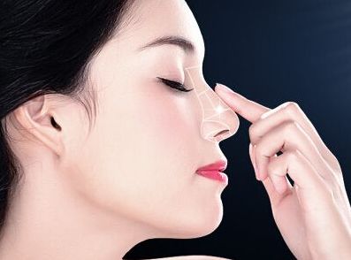 深圳隆鼻哪家好？易培金醫(yī)生經(jīng)驗(yàn)口碑解析測(cè)評(píng)