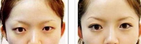 天津有沒(méi)有靠譜的去皺美容醫(yī)院？