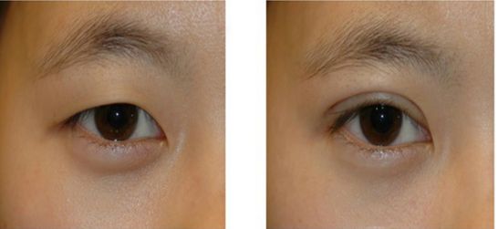 武漢最好的整形美容醫(yī)院哪家？