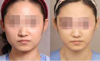 湛江有哪些頂尖整形美容醫(yī)院值得關(guān)注？