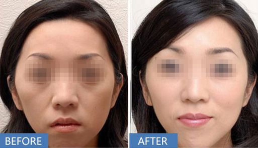 南通市哪家微整形醫(yī)院好？