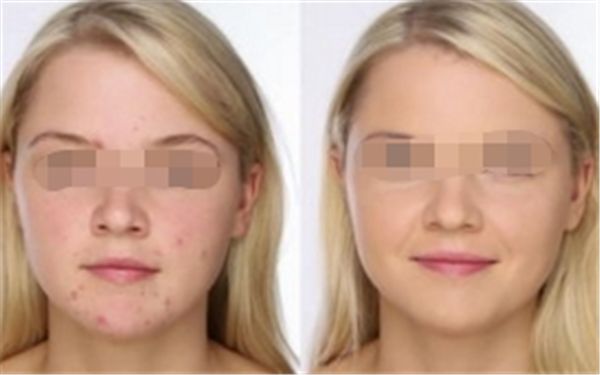 2024年樂山哪家正畸醫(yī)院技術(shù)排名靠前？