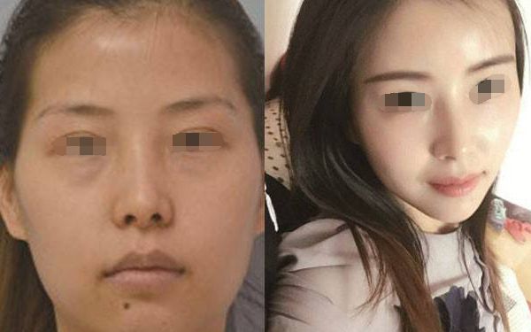 松原市哪家整形醫(yī)院效果好？