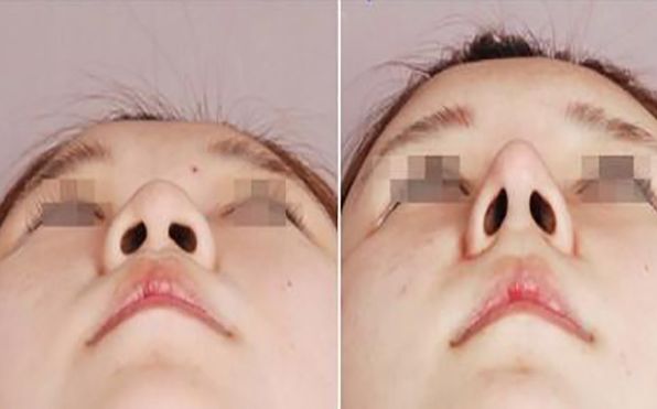 中國(guó)吸脂手術(shù)，選擇哪家醫(yī)院更合適？