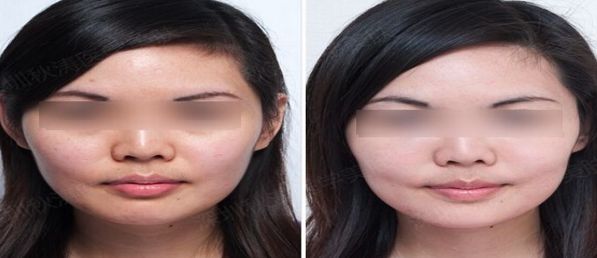 2024年溫州祛疤痕醫(yī)院排名與口碑榜單【前五強(qiáng)】