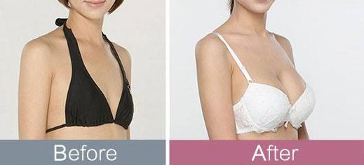 東莞哪家整形醫(yī)院頗受推薦？