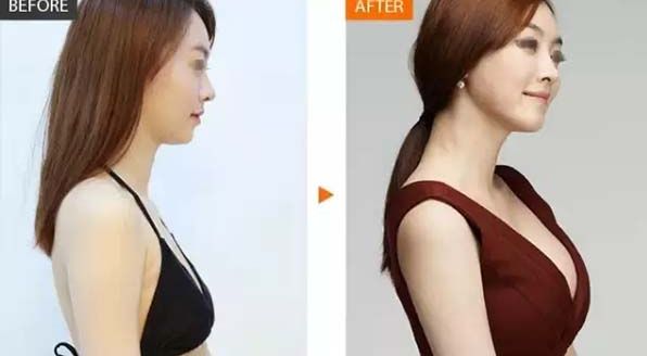 長沙哪家雙眼皮醫(yī)院排名靠前呢？