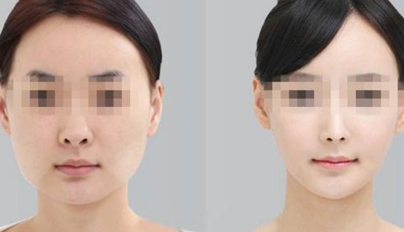 湖南省隆鼻整形醫(yī)院排行榜發(fā)布！哪家整形醫(yī)院效果好又靠譜？