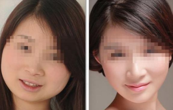 寧波哪家醫(yī)院隆鼻效果好, 技術(shù)專業(yè)有口碑的醫(yī)院排行